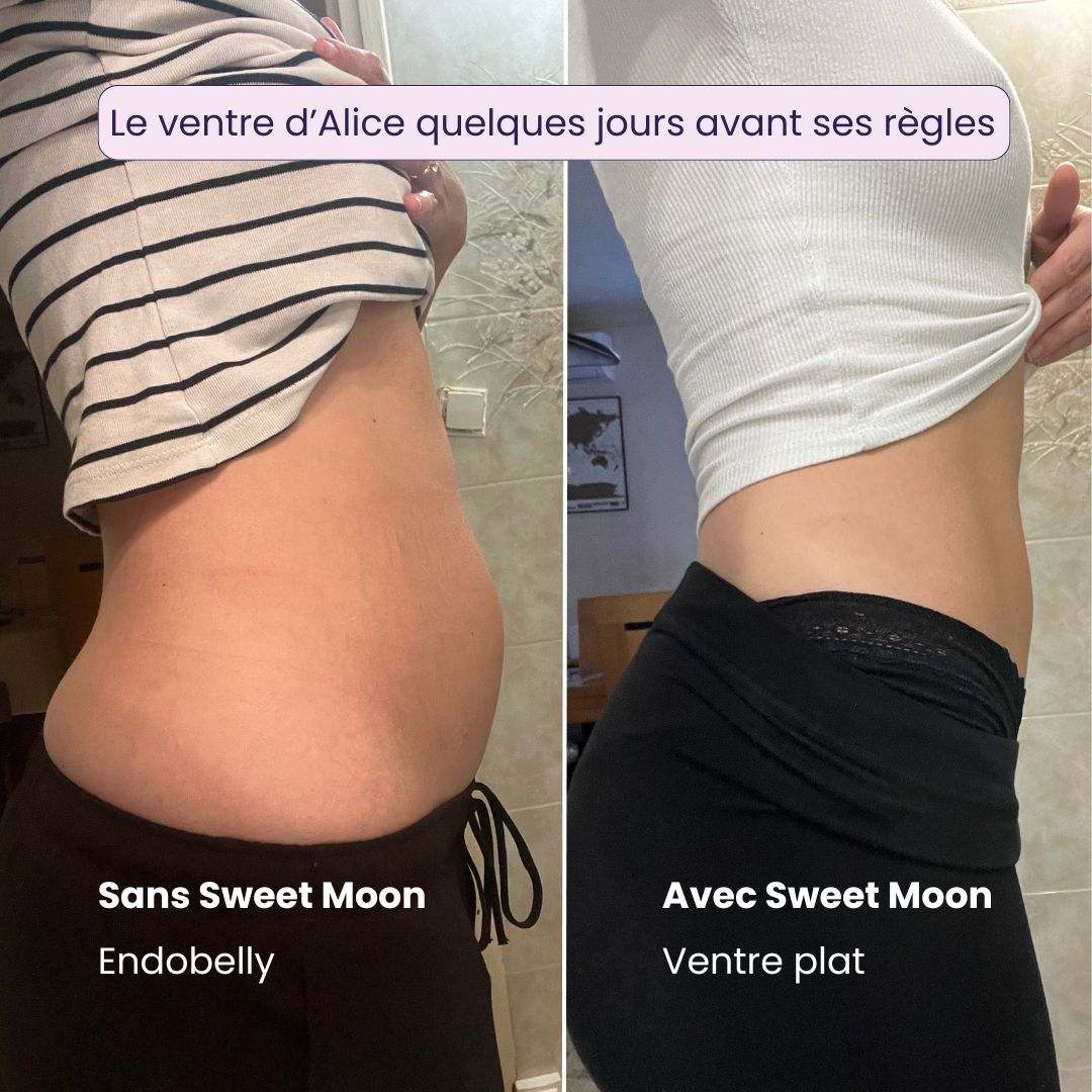 Règles douloureuses & Endométriose - Cure BIO Sweet Moon