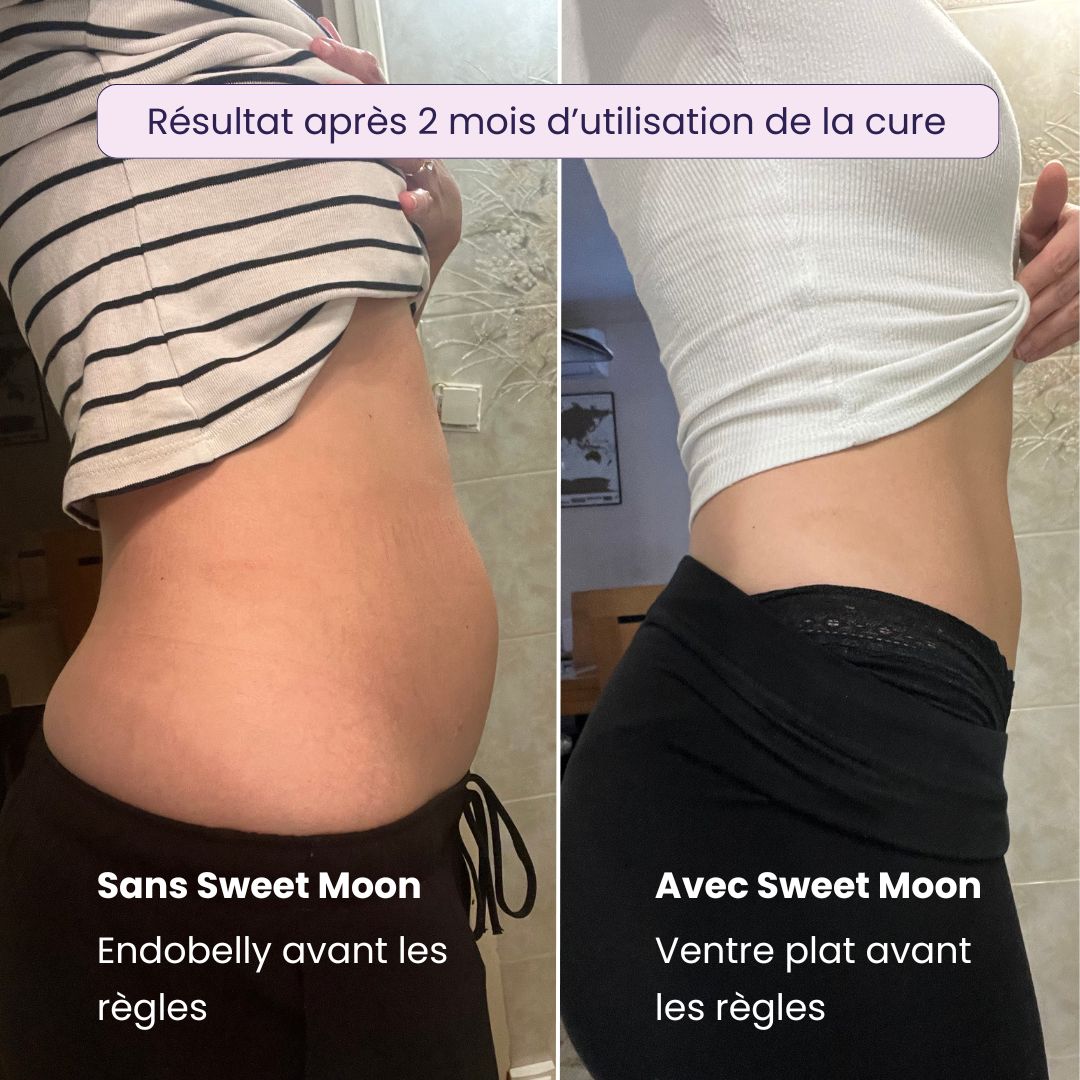 Règles douloureuses & Endométriose - Cure BIO Sweet Moon